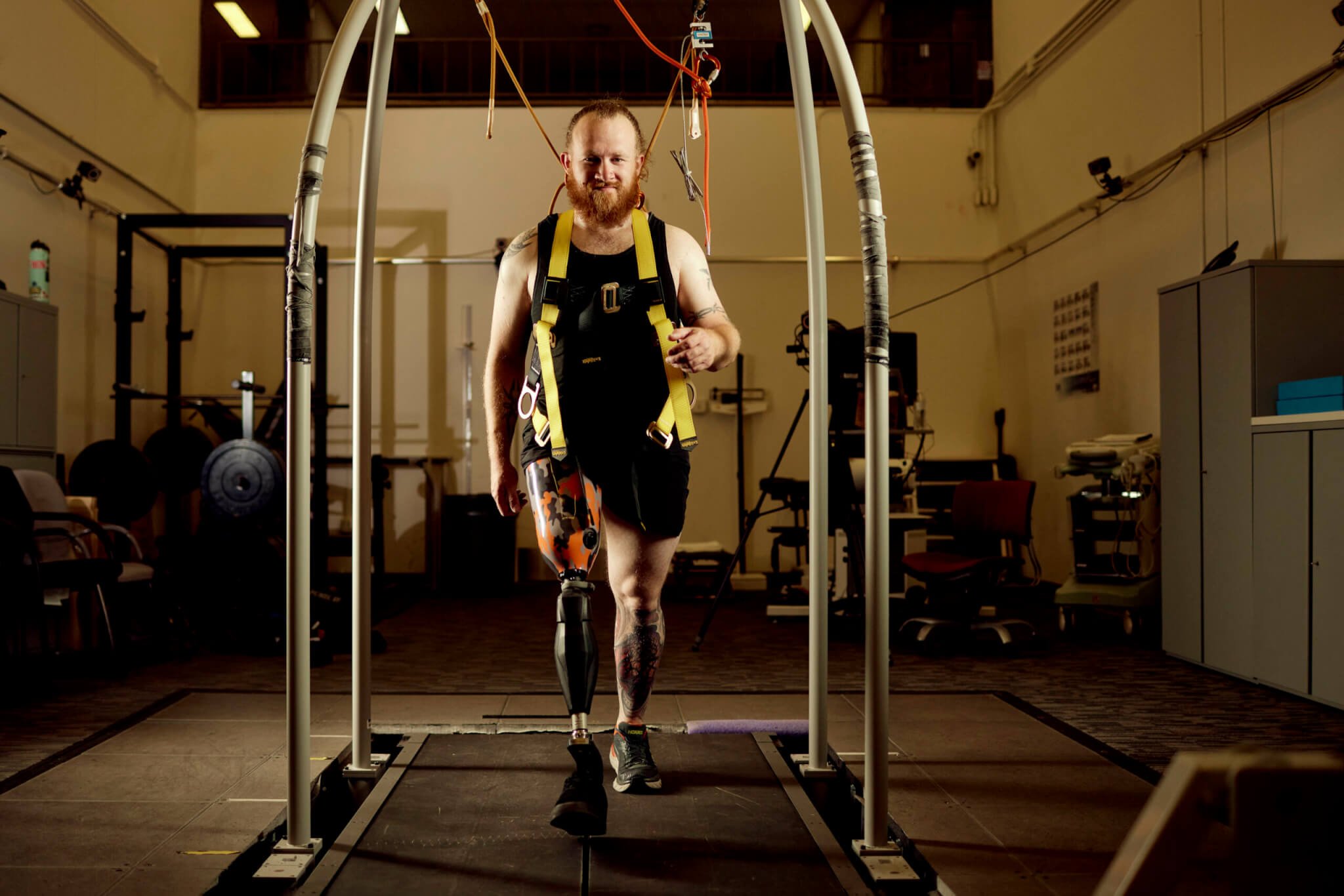 Exploring the Human Factor in Prosthetic Adaptation